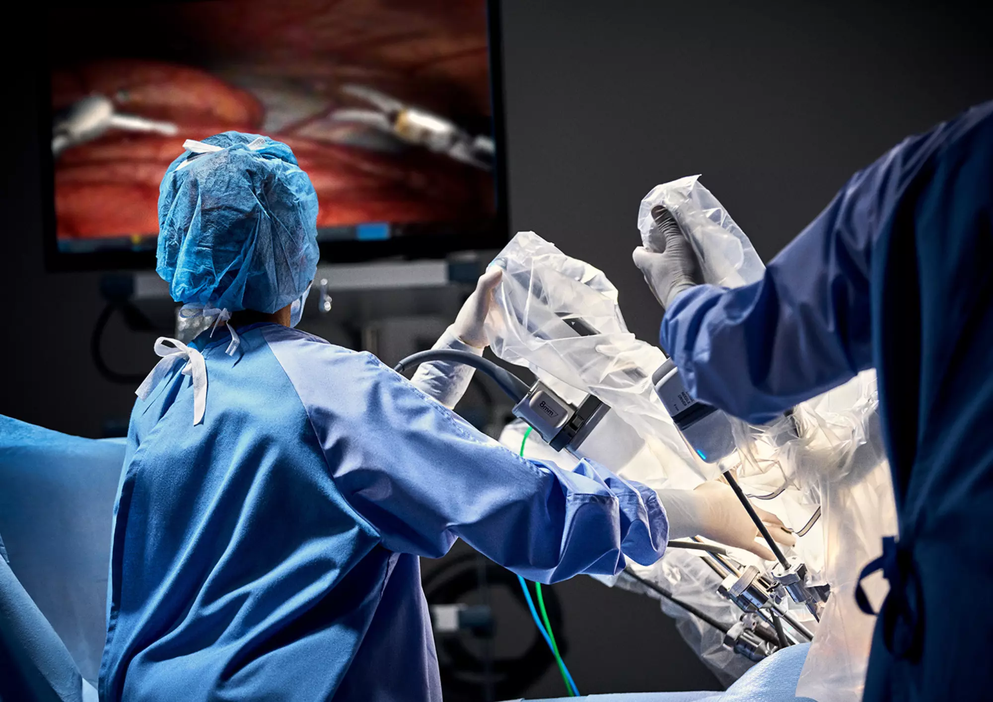 Surgeons operating the Da Vinci xi robotic surgery equipment.